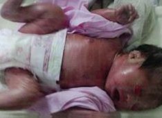 试管婴儿移植5aa囊胚怎么样