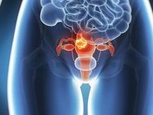 试管婴儿费用怎么收的，做完这些项目流程可能要十几万